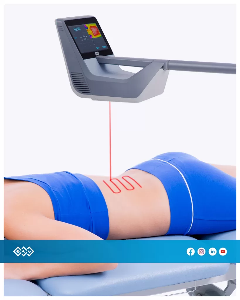 PROCEDURI-LASER DE INALTA INTENSITATE