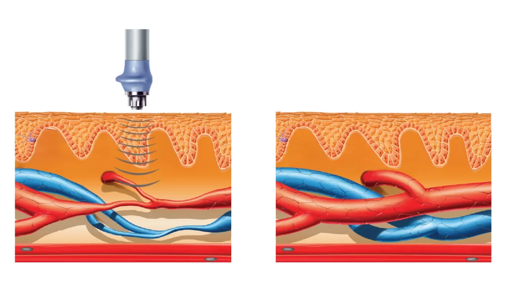 PROCEDURI-UNDA DE SOC REUMADIAGNOSTIC