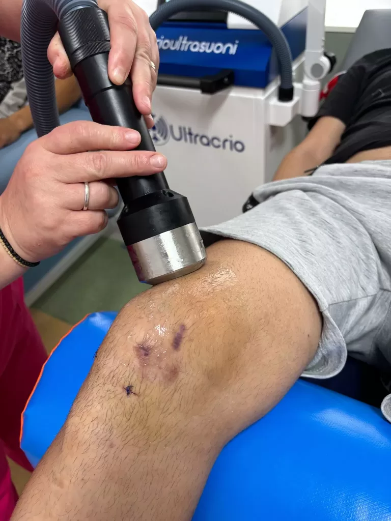 Terapia cu CrioUltrasunete