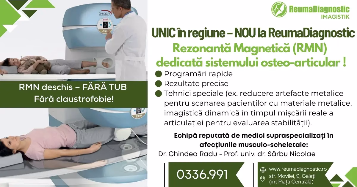 Solutiaidealapentrudiagnosticareaafectiunilormusculo-scheletale