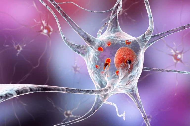 boli-neuronale