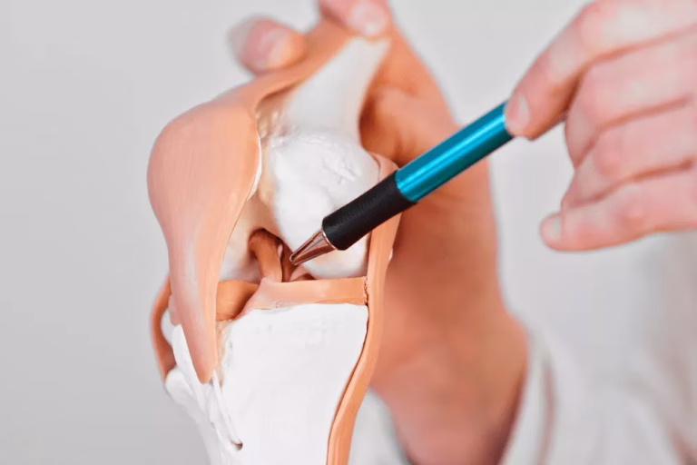 ligament_incrucisat_anterior