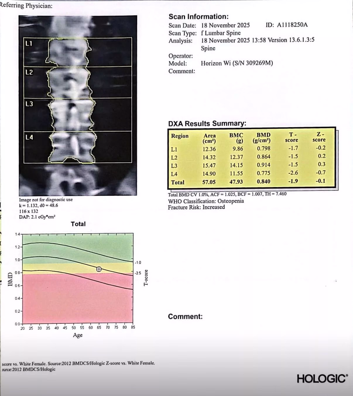 Interpretare T Score DEXA Osteoporoză Normal Osteopenie